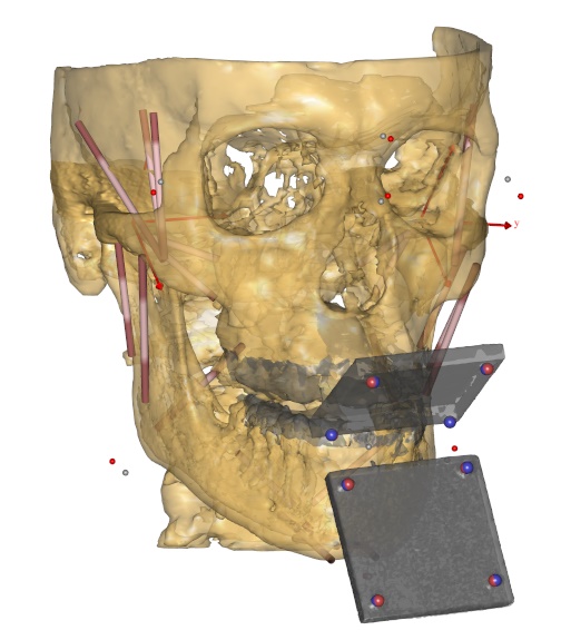 ../_images/AalborgMandible.jpg