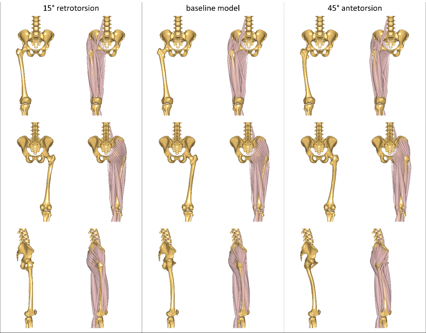 ../../_images/femoral-torsion_2.png